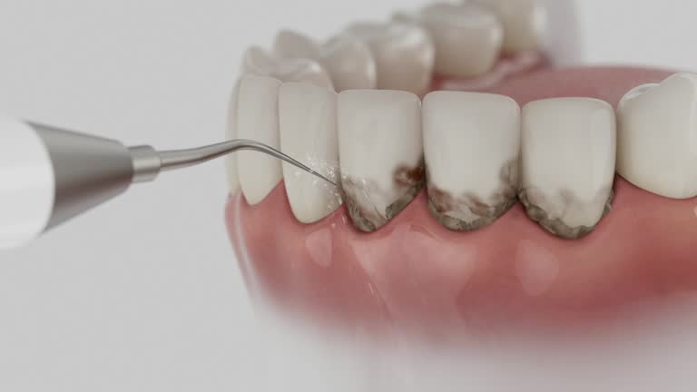 Trusted Invisalign Clear Aligners service in Fair Oaks, VA - Dentist Open Now